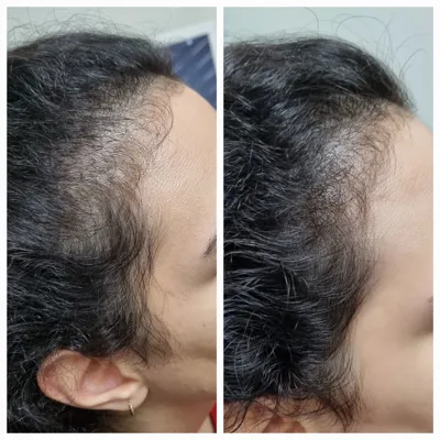 بهترين مركز درمان مو و پوست در غرب تهران
