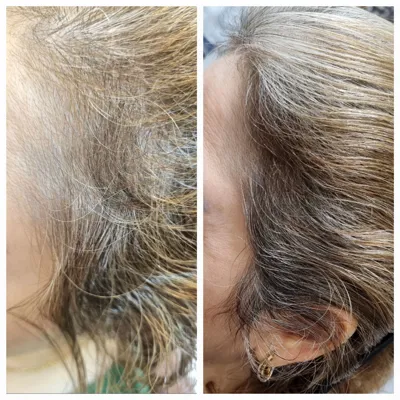 اولين مركز درمان مو و پوست در تهران ايران
