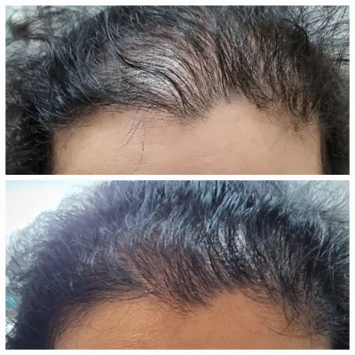 اولين مركز درمان مو و پوست در تهران ايران
