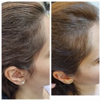 اولين مركز درمان مو و پوست در تهران ايران
