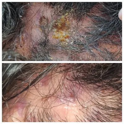 اولين مركز درمان مو و پوست در تهران ايران
