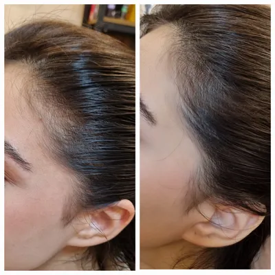 اولين مركز درمان مو و پوست در تهران ايران
