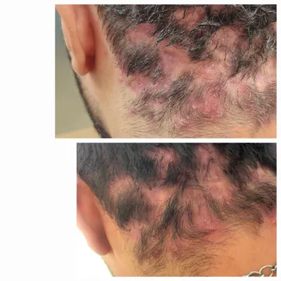 اولين مركز درمان مو و پوست در تهران ايران
