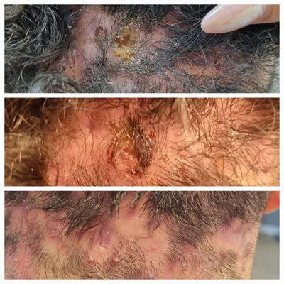 بهترين مركز درمان مو و پوست در تهران ايران
