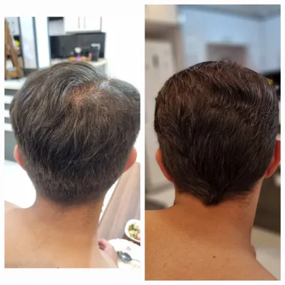 بهترين مركز درمان مو و پوست در تهران ايران
