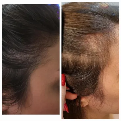 اولين مركز درمان مو و پوست در تهران ايران
