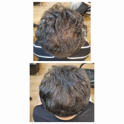 معتبرترين مركز درمان مو و پوست در تهران ايران
