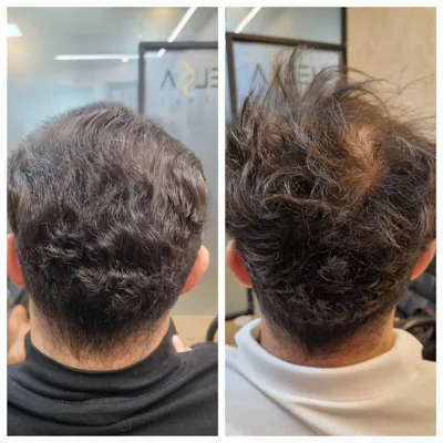 بهترين مركز درمان مو و پوست در تهران ايران
