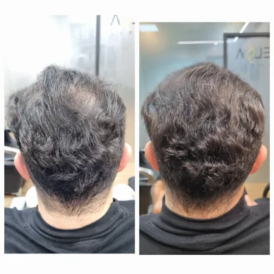 اولين مركز درمان مو و پوست در تهران ايران
