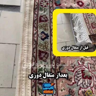 متقال دوزی ریشه😍