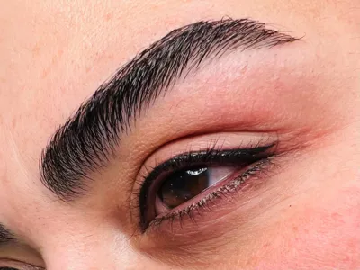 میکروبلیدینگ شرق تهران