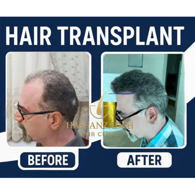 دکتر حسن زاده