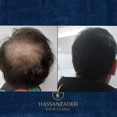 دکتر حسن زاده