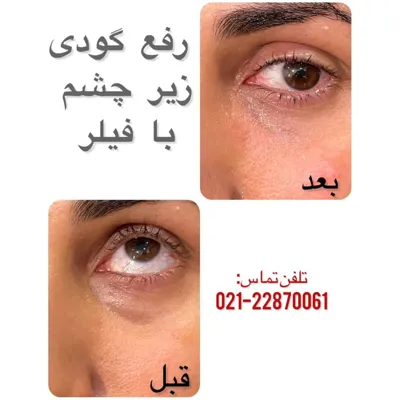 کلینیک جراحی زیبایی تهران