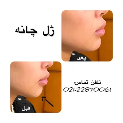 جراحی زیبایی تهران