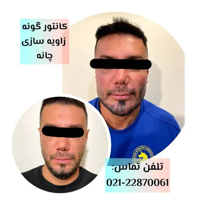 کلینیک زیبایی در تهران