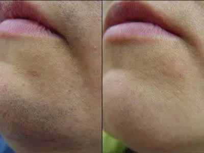 آدرس مرکز لیزر در بروجرد