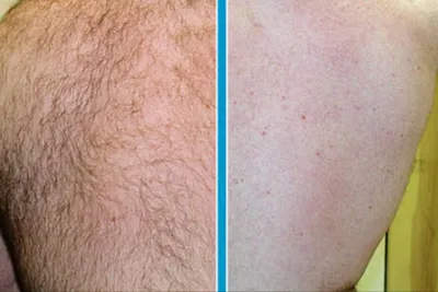 مرکز لیزر در بروجرد