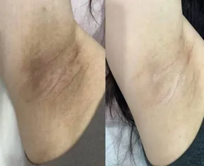 آدرس مرکز لیزر در بروجرد