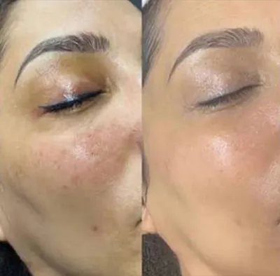 مرکز لیزر در بروجرد