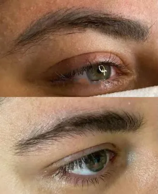 خدمات لیزر در بروجرد