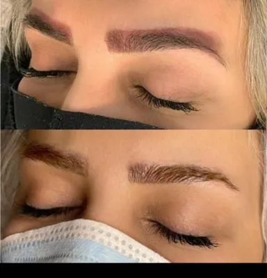 خدمات لیزر در بروجرد