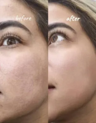 آدرس مرکز لیزر در بروجرد