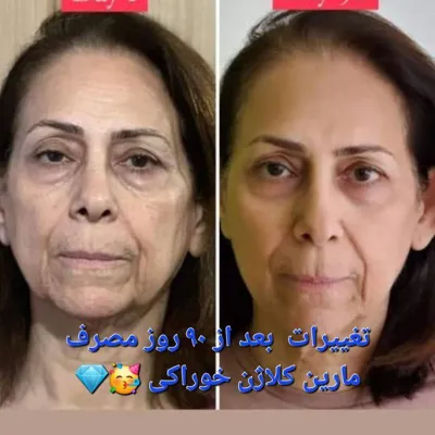 بهترین خمیر دندان گیاهی دنیا