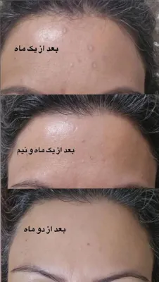 بهترین خمیر دندان گیاهی دنیا