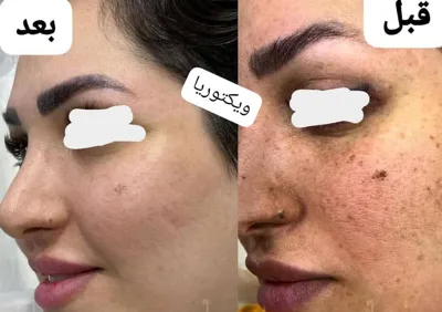 ✧°زیباکده جاوید✧°