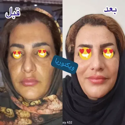 ✧°زیباکده جاوید✧°