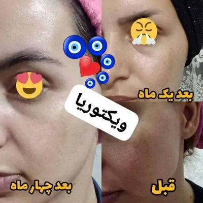 ✧°زیباکده جاوید✧°