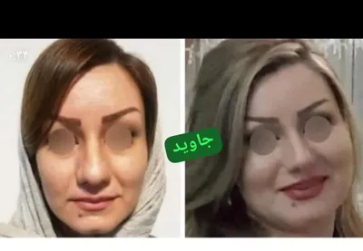 ✧°زیباکده جاوید✧°