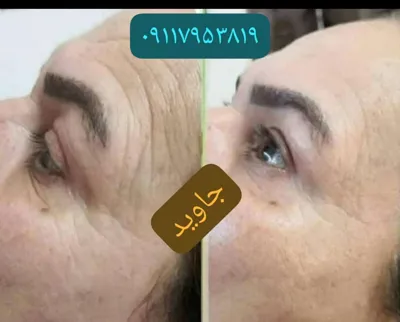 ✧°زیباکده جاوید✧°