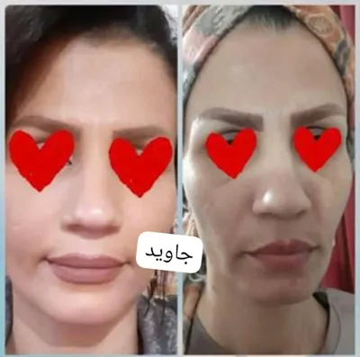 ✧°زیباکده جاوید✧°