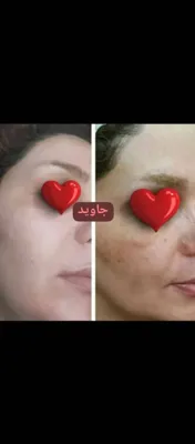 ✧°زیباکده جاوید✧°