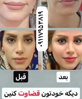 ✧°زیباکده جاوید✧°