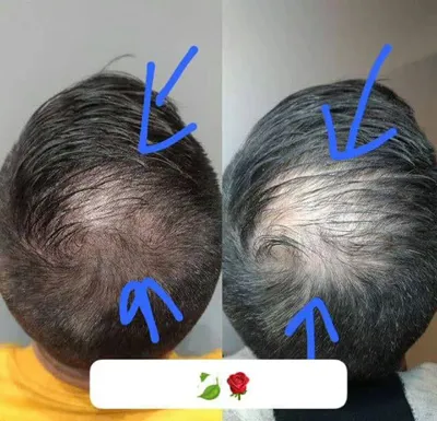 ✧°زیباکده جاوید✧°