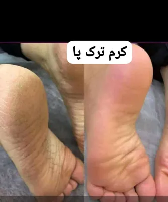 ✧°زیباکده جاوید✧°