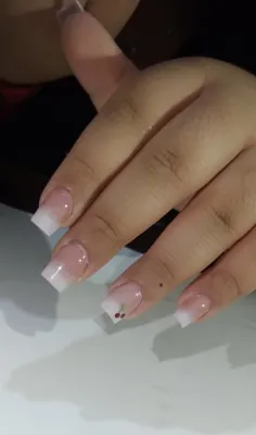 کاشت امبره طرح گیلاسی