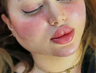 تزریق ژل و بوتاکس در شیراز.کلینیک زیبایی دنیا در شیراز