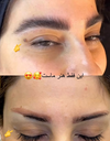 ریمو تتو در کرمان
