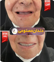 دندان مصنوعی در سیستان و بلوچستان