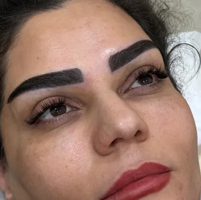نمونه کار مرکز کاشت ابرو در کرج