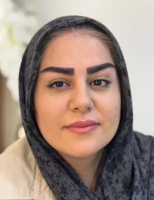 کاشت ابرو طبیعی در کرج