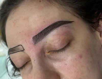 کاشت ابرو نچرال در کرج