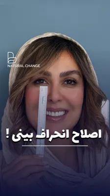 لیفت بینی