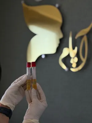 مرکز لیزر مو آپام در بردیس