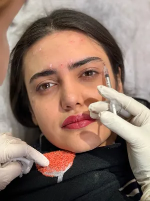 تزریق ژل در فردیس