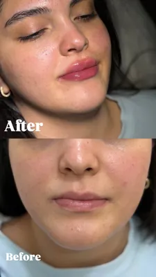 مرکز ژل لب در فردیس